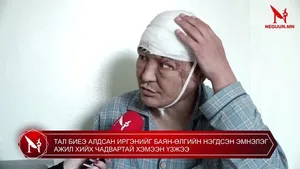 ТАЛ БИЕЭ АЛДСАН ИРГЭНИЙГ БАЯН-ӨЛГИЙН НЭГДСЭН ЭМНЭЛЭГ АЖИЛ ХИЙХ ЧАДВАРТАЙ ХЭМЭЭН ҮЗЖЭЭ
