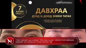 “ГОЁЛ КЛИНИК”-ЫН САЛБАР “PRO ONE CLINIC” ҮЙЛЧЛҮҮЛЭГЧИЙНХЭЭ ЗОВХИЙГ ХЭТ ДЭЭШ НЬ ТАТАЖ ОЁСОН ГЭВ